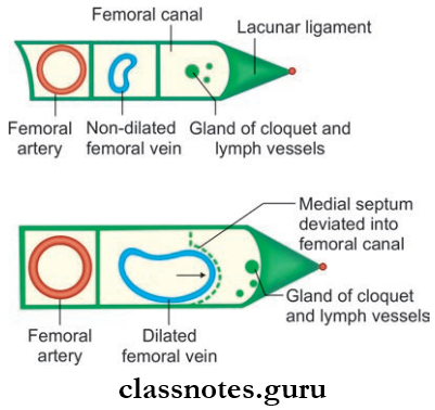 Lower Limb Introduction And Front Of Thing Depict Use Of Femoral Canal