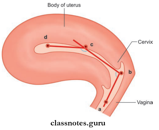 Male And Female Reproductive Organs Normal Anteverted And ANteflexed Positions Of Uterus