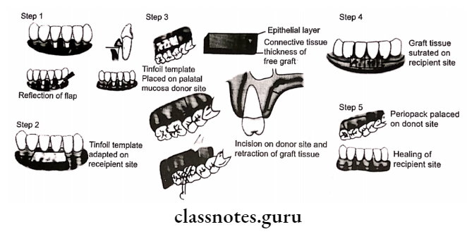 Mucogingival Surgery Various steps in claaic techique