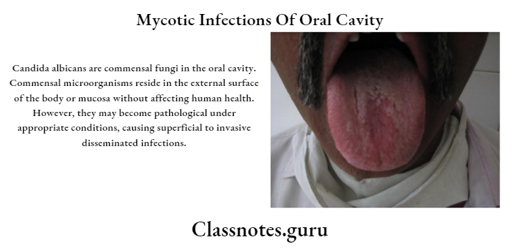 Mycotic Infections Of Oral Cavity