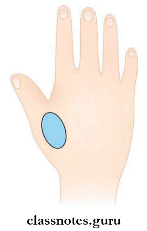 Nerves Of Upper Limb Coin Shaped Are Of Sensory Loss On Dorsum Of Hand