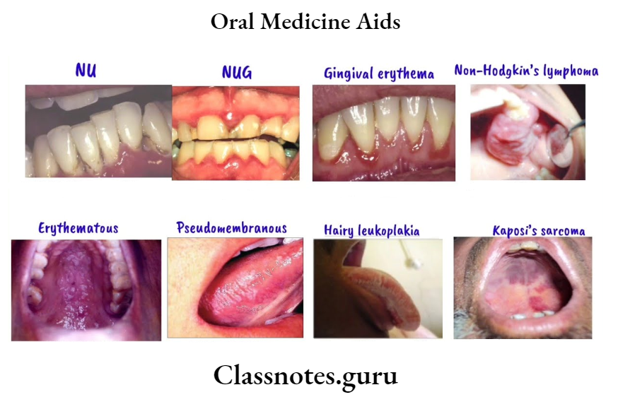 Oral Medicine Aids