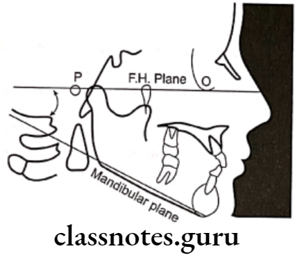 Orthodontics Cephalometrics Mandibular plane angle 1
