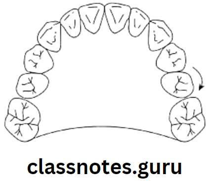 Orthodontics Classification Of Malocclusion Disto lingial rotation