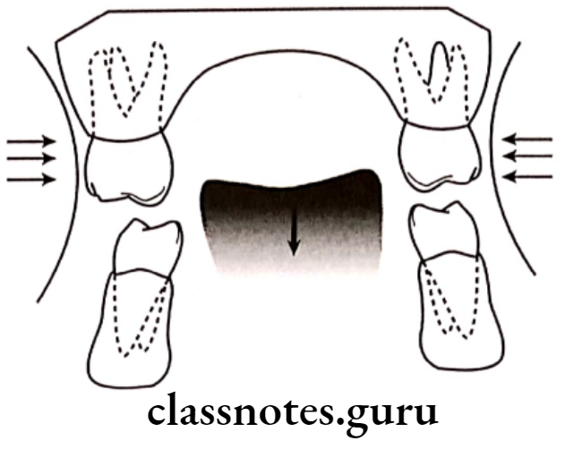 Orthodontics Functional Development Oral Cavity