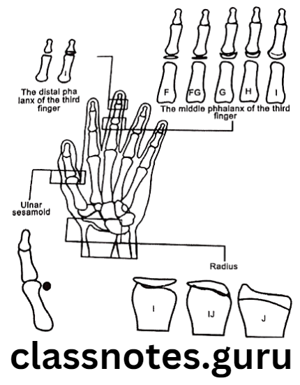 Orthodontics Skeletal Maturity Indicators Hand-Wrist radiograph assessment by Hogg and Taranger