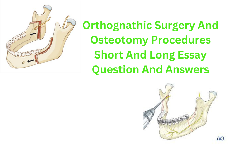 Orthognathic Surgery Question And Answers
