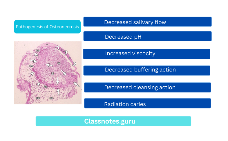 Pathogenesis of Osteonecrosis
