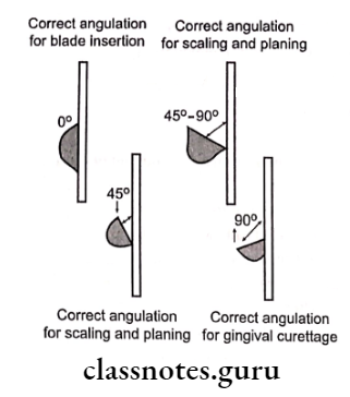 Principles Of Periodontal Instrumentation Correct angulation for blade insertion