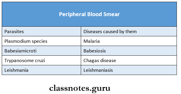 Protozoans Peripheral blood smear