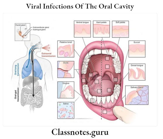 Viral Infections Of The Oral Cavity