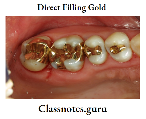 Direct Filling Gold