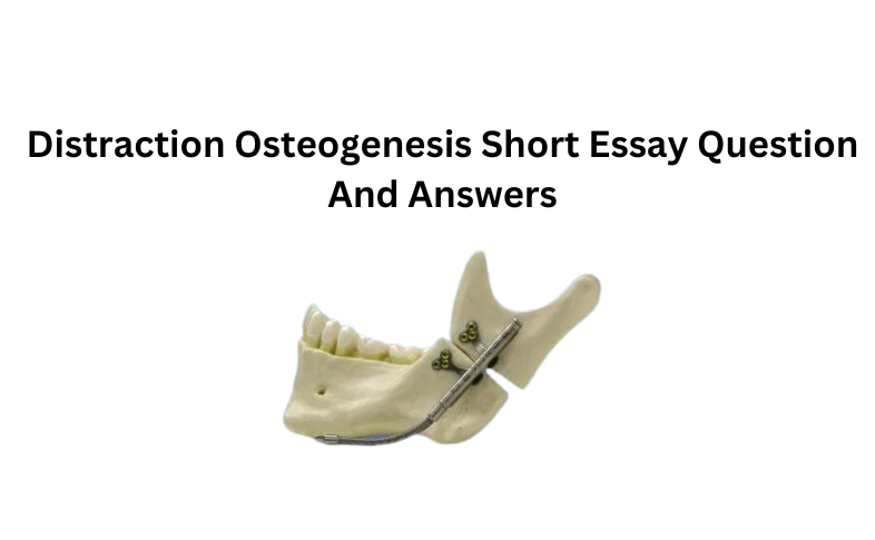 Distraction Osteogenesis Short Essay Question And Answers