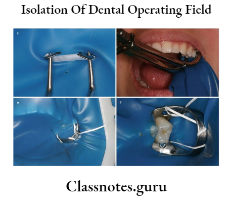 Isolation Of Dental Operating Field