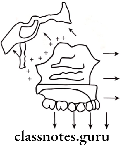 Orthodontics Cleft Lip And Palate Primary displacement of maxilla
