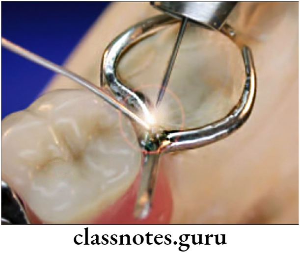 Orthodontics Lab Procedures Soldering In Procedures