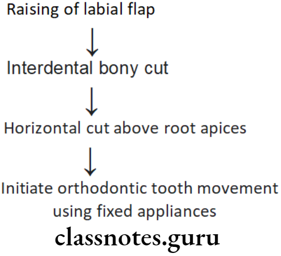 Orthodontics Surgical Orthodontics Corticotomy Procuedure