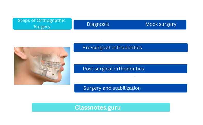 Steps of Orthognathic Surgery