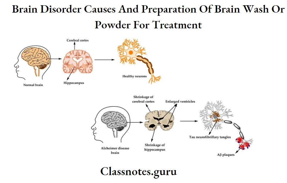 Brain Disorder Causes And Preparation Of Brain Wash Or Powder For Treatment Brain Problems
