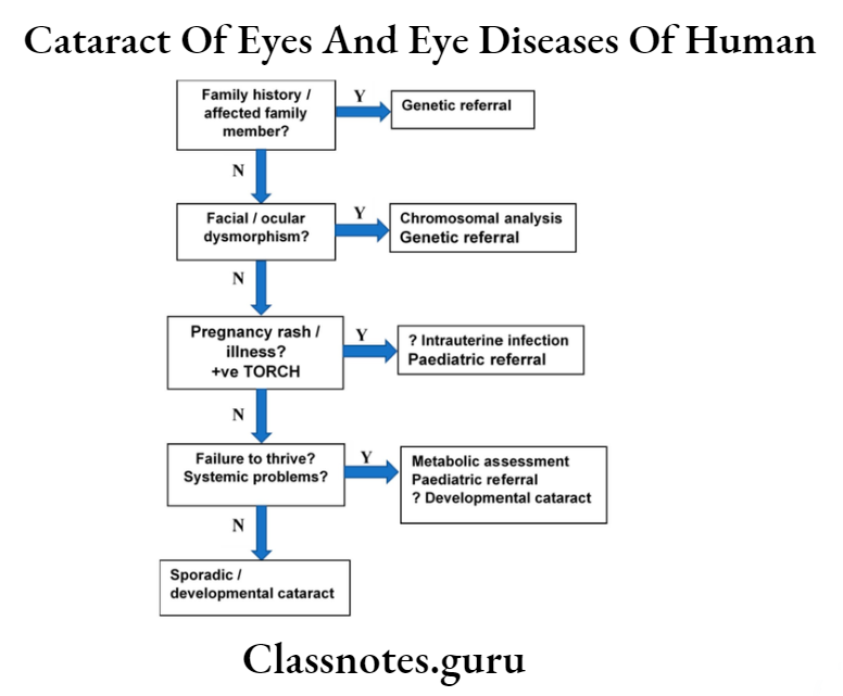 Cataract Of Eyes And Eye Diseases Of Human flow Illustrate Diagnostic Steps For Congential And Develpoment contract
