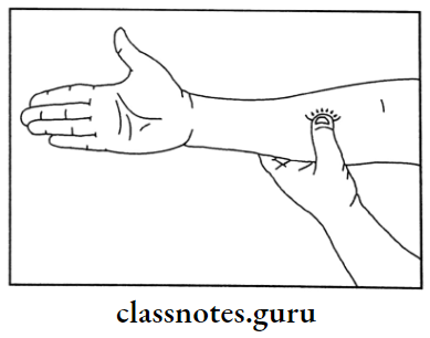 Common Diseases The Middle Circle In Right Hand Front Side