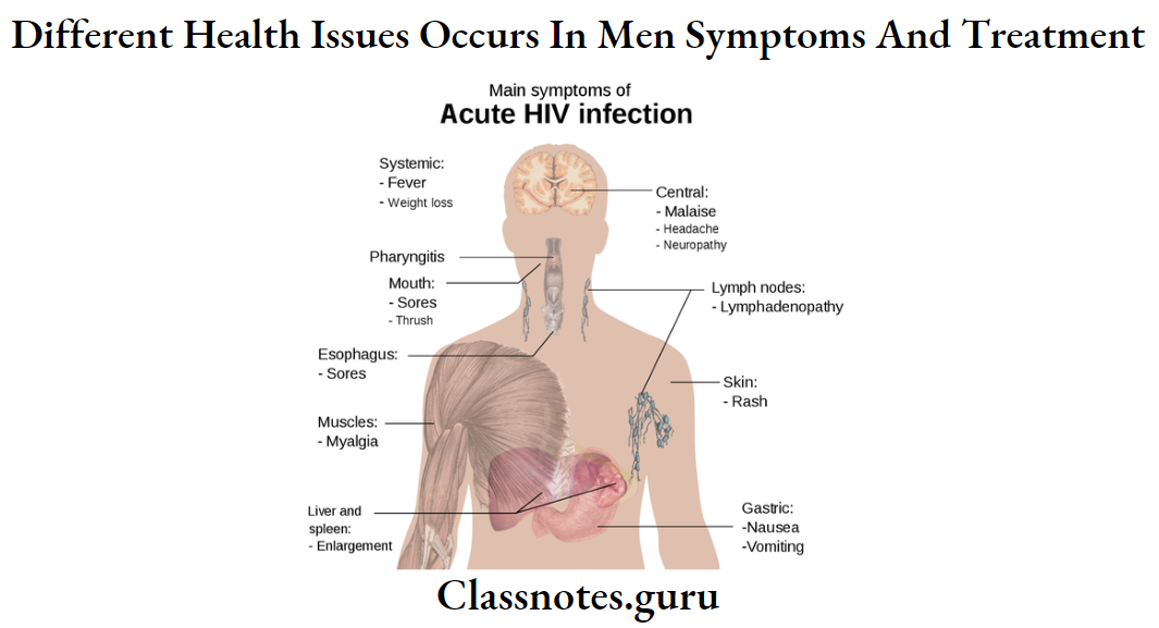 Different Health Issues Occurs In Men Symptoms And Treatment Actue HIV Infection