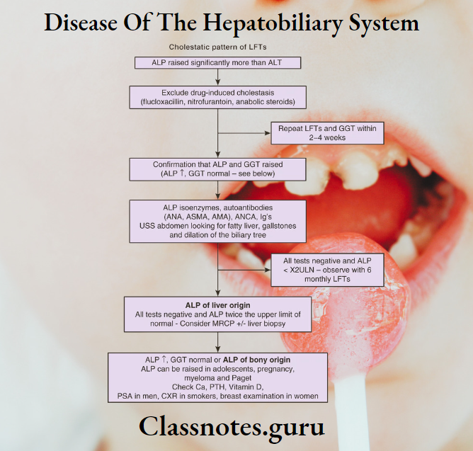 Disease Of The Hepatobiliary System Cholestatic Pattern Of LFTs