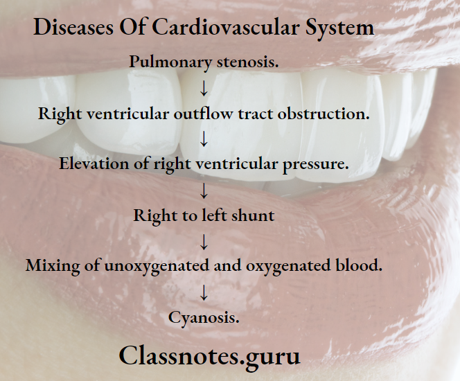 Diseases Of Cardiovascular System Pathogenesis..