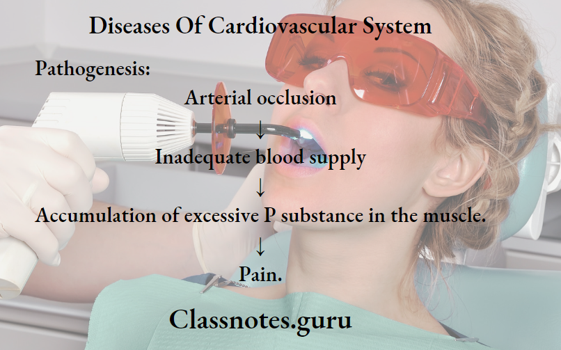Diseases Of Cardiovascular System Pathogenesis