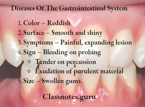 Diseases Of The Gastrointestinal System Gingival