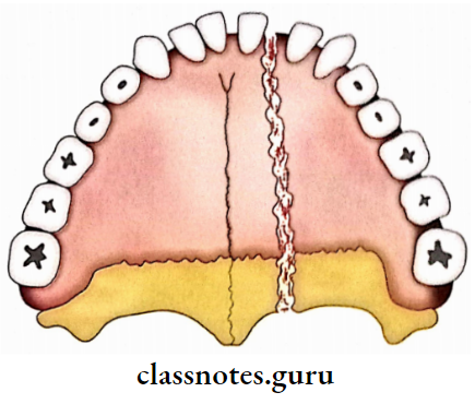 Exterior Of The Skull Central Split Of Palate