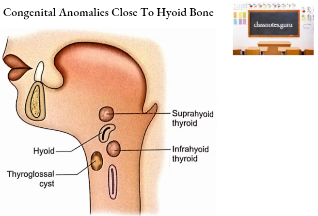 Hyoid Congenital Anomalies Close To Hyoid Bone