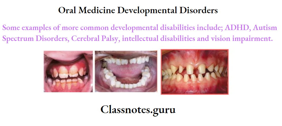 Oral Medicine Developmental Disorders