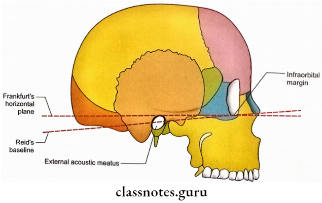 Skull General Features Skull In Relation To Horizontal Planes
