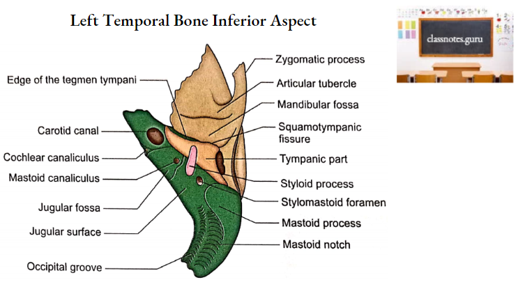 Temporal Bones Left Temporal Bone Inferior Aspect