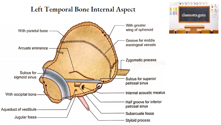 Temporal Bones Left Temporal Bone Internal Aspect