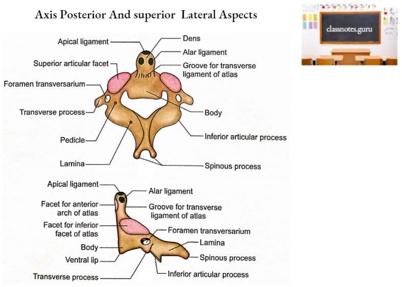 Vertebrae Axis Posterior And superior Lateral Aspects