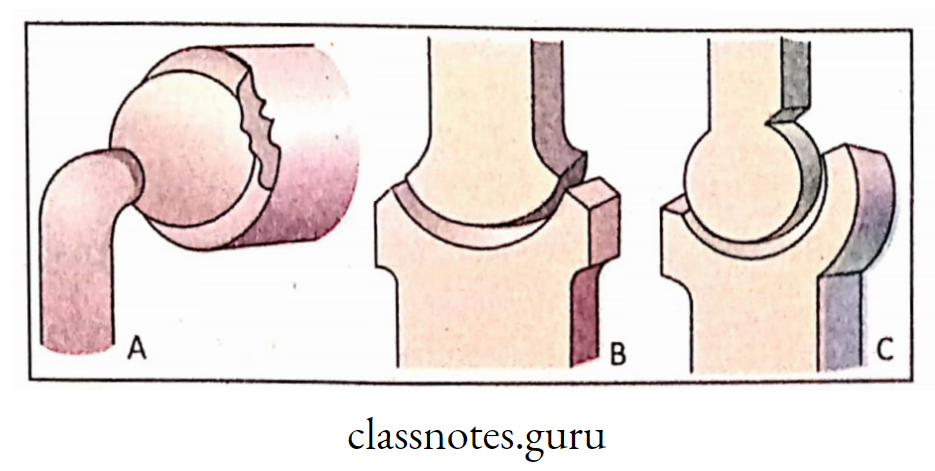 A. Ball and Socket Joint; B & C. Hinge joint.