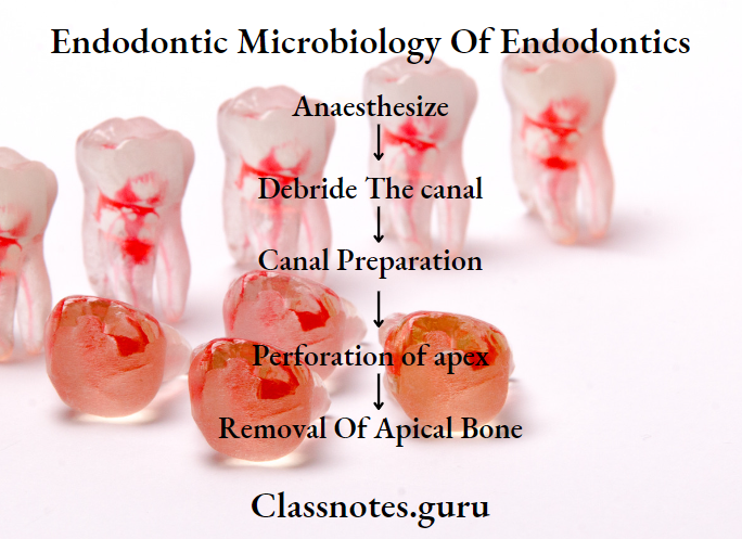 Endodontics Miscellaneous Endodontic Implants Procedure