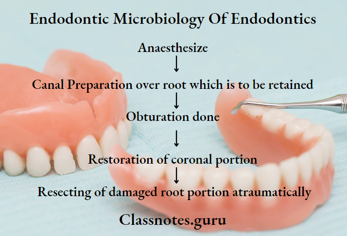 Endodontics Miscellaneous Immediate root resection Procedure